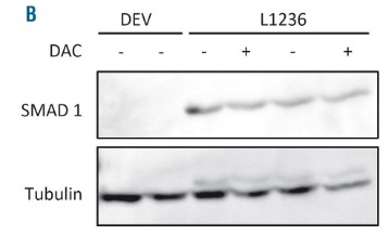 SMAD1 expression at the protein level after no treatment.jpg